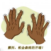 顫抖，帕金森病的開(kāi)端 帕金森的癥狀有哪些
